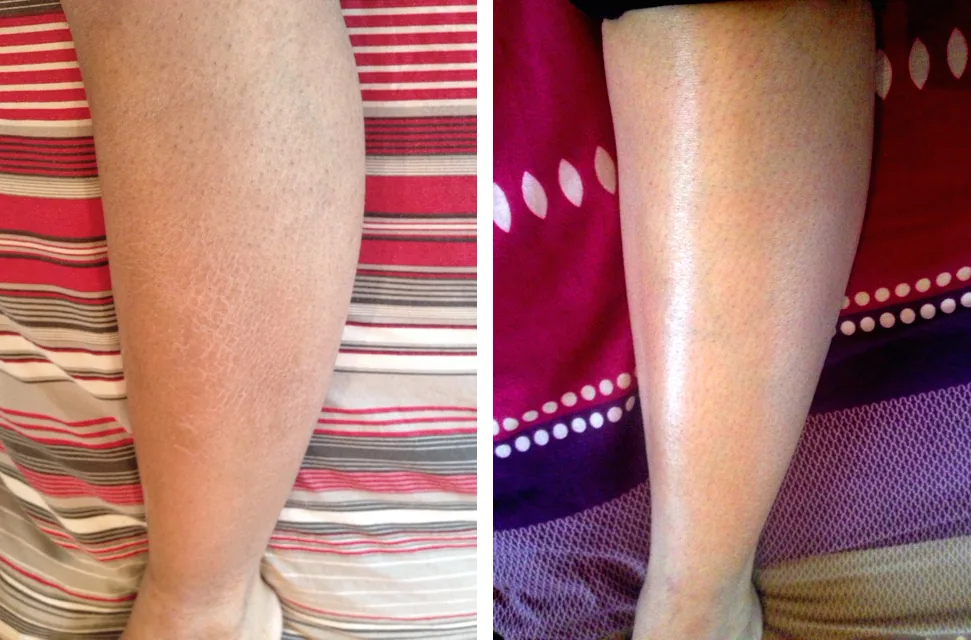 Pelle prima e dopo l’uso di G16 Skin Repair Lotion