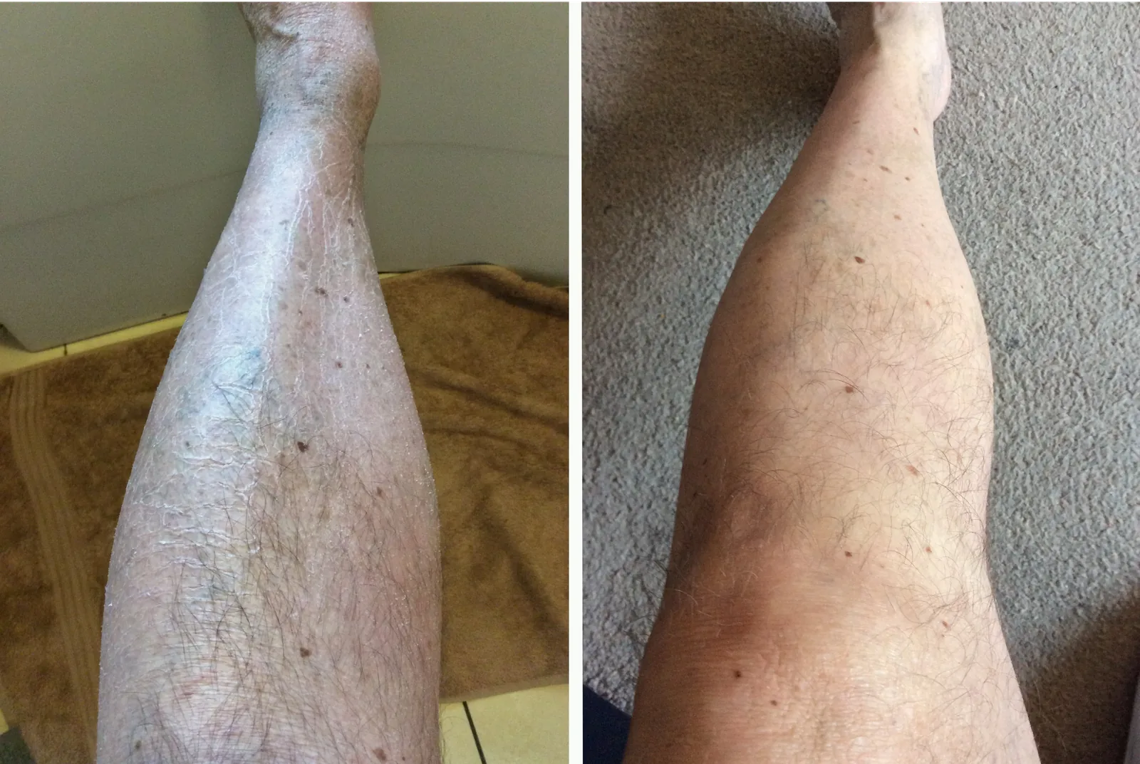 Pelle prima e dopo l’uso di G16 Skin Repair Lotion