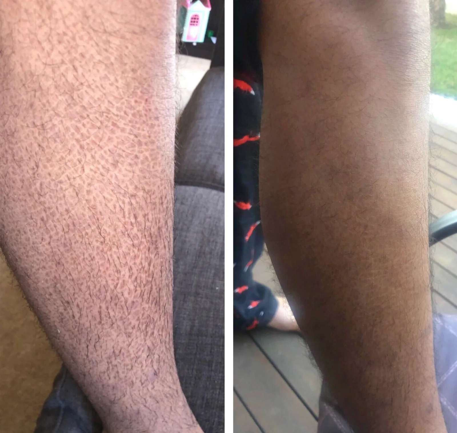 Pelle prima e dopo l’uso di G16 Skin Repair Lotion