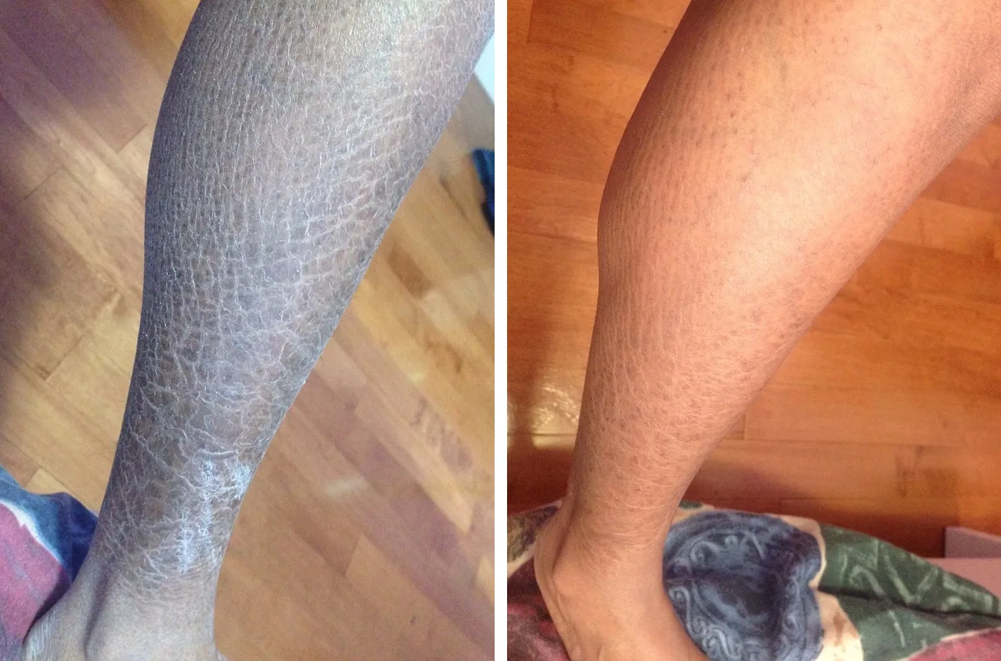 Pelle prima e dopo l’uso di G16 Skin Repair Lotion