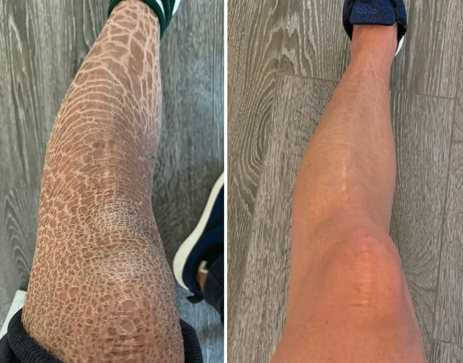 Pelle prima e dopo l’uso di G16 Skin Repair Lotion