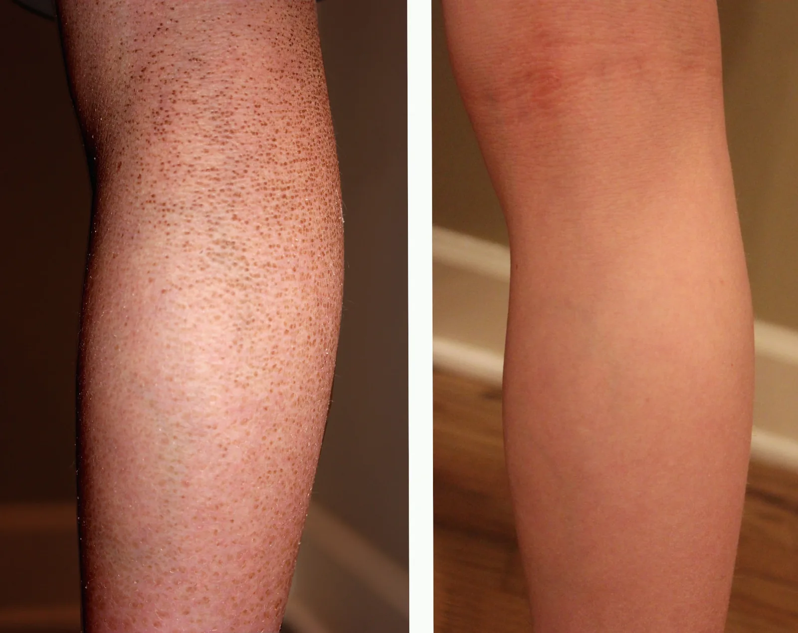 Pelle prima e dopo l’uso di G16 Skin Repair Lotion